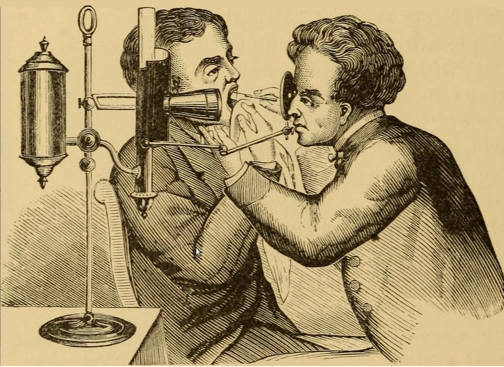 picture of Tobold laryncoscope model of 1869